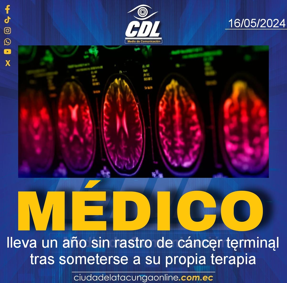 Médico lleva un año sin rastro de cáncer terminal tras someterse a su propia terapia