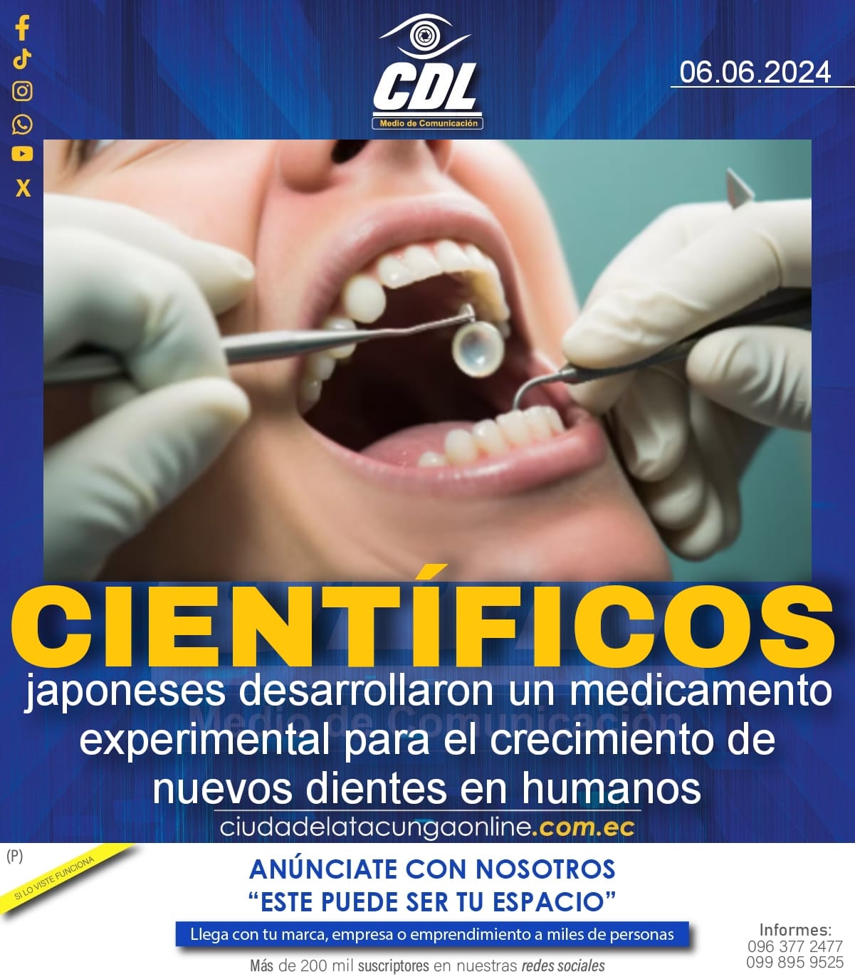 Científicos japoneses desarrollaron un medicamento experimental para el crecimiento de nuevos dientes en humanos
