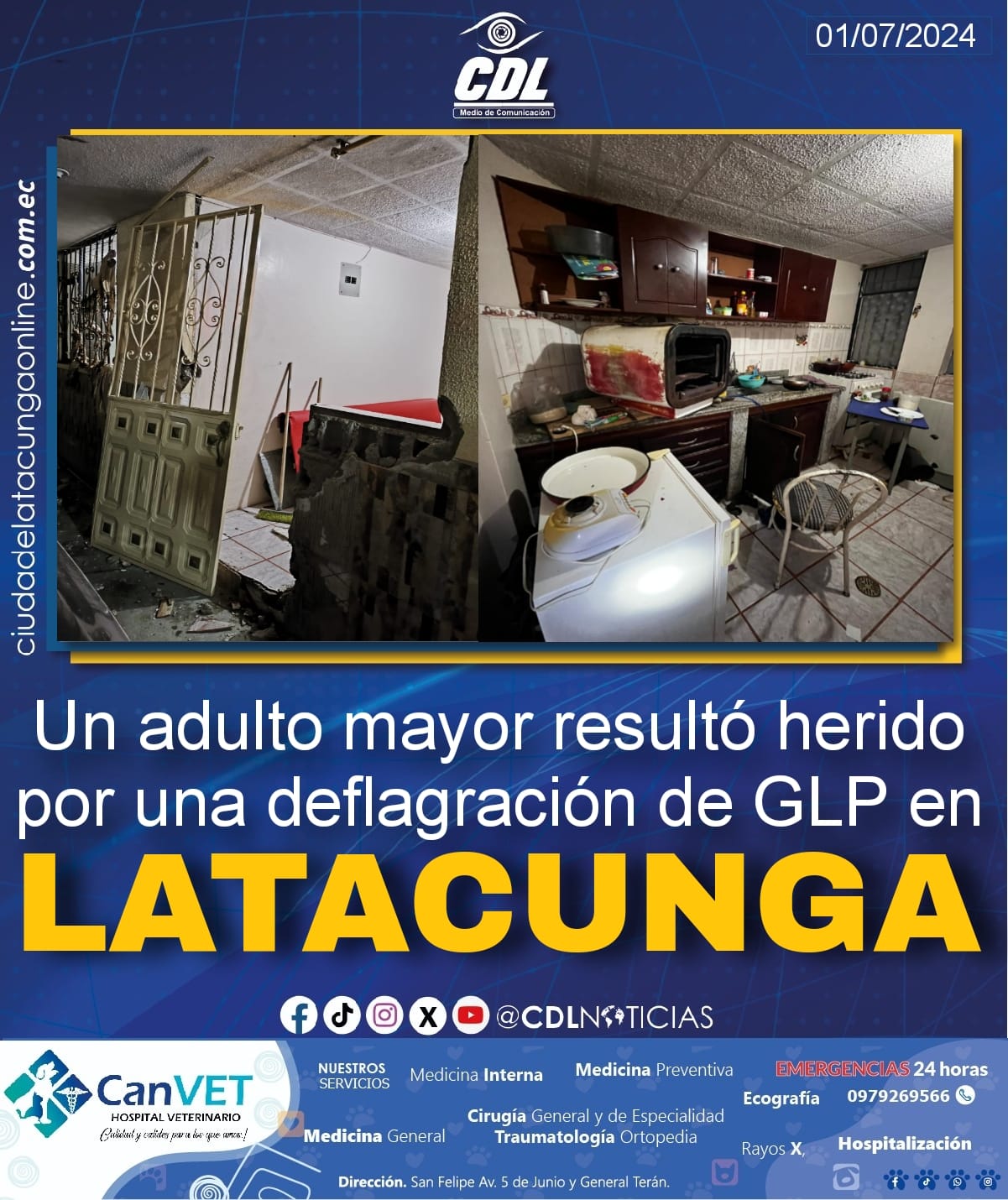 Un adulto mayor resultó herido por una deflagración de GLP en Latacunga