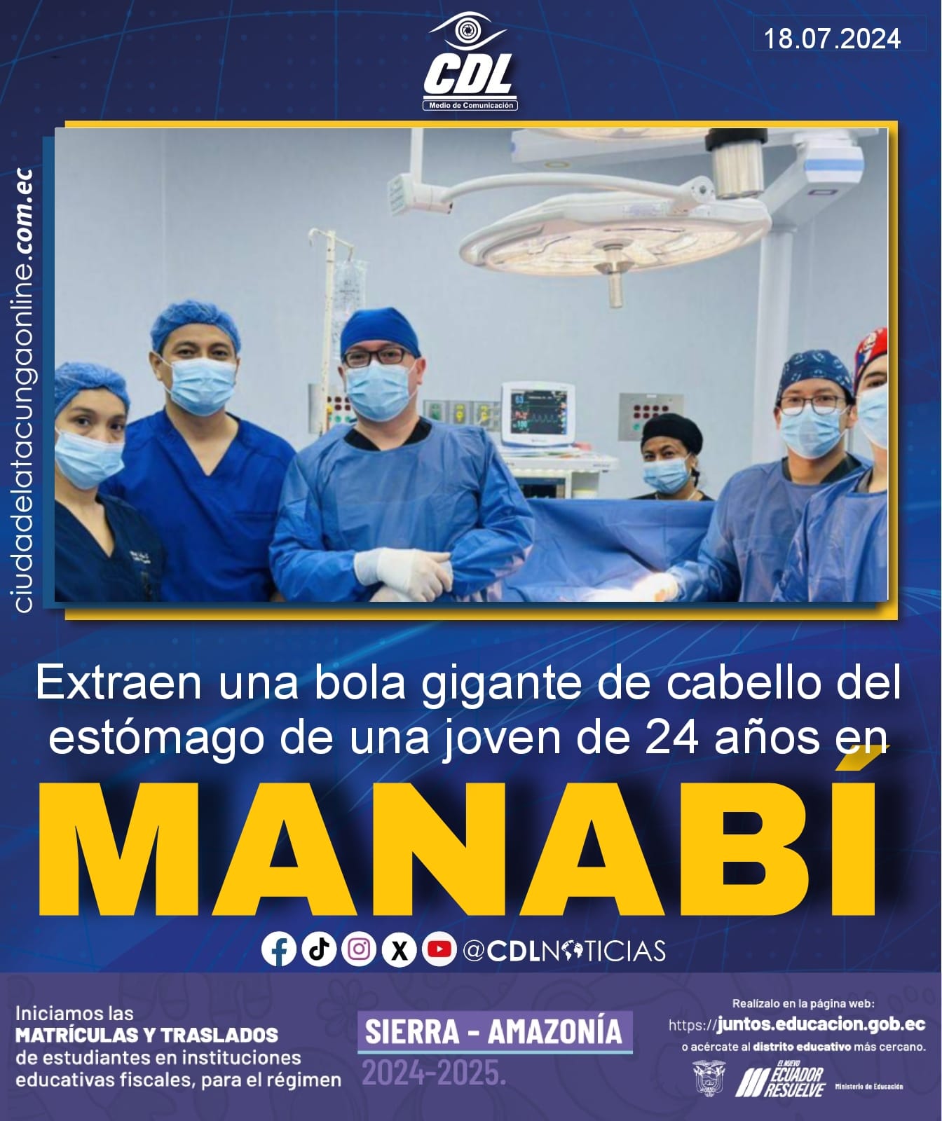 Extraen una bola gigante de cabello del estómago de una joven de 24 años en Manabí