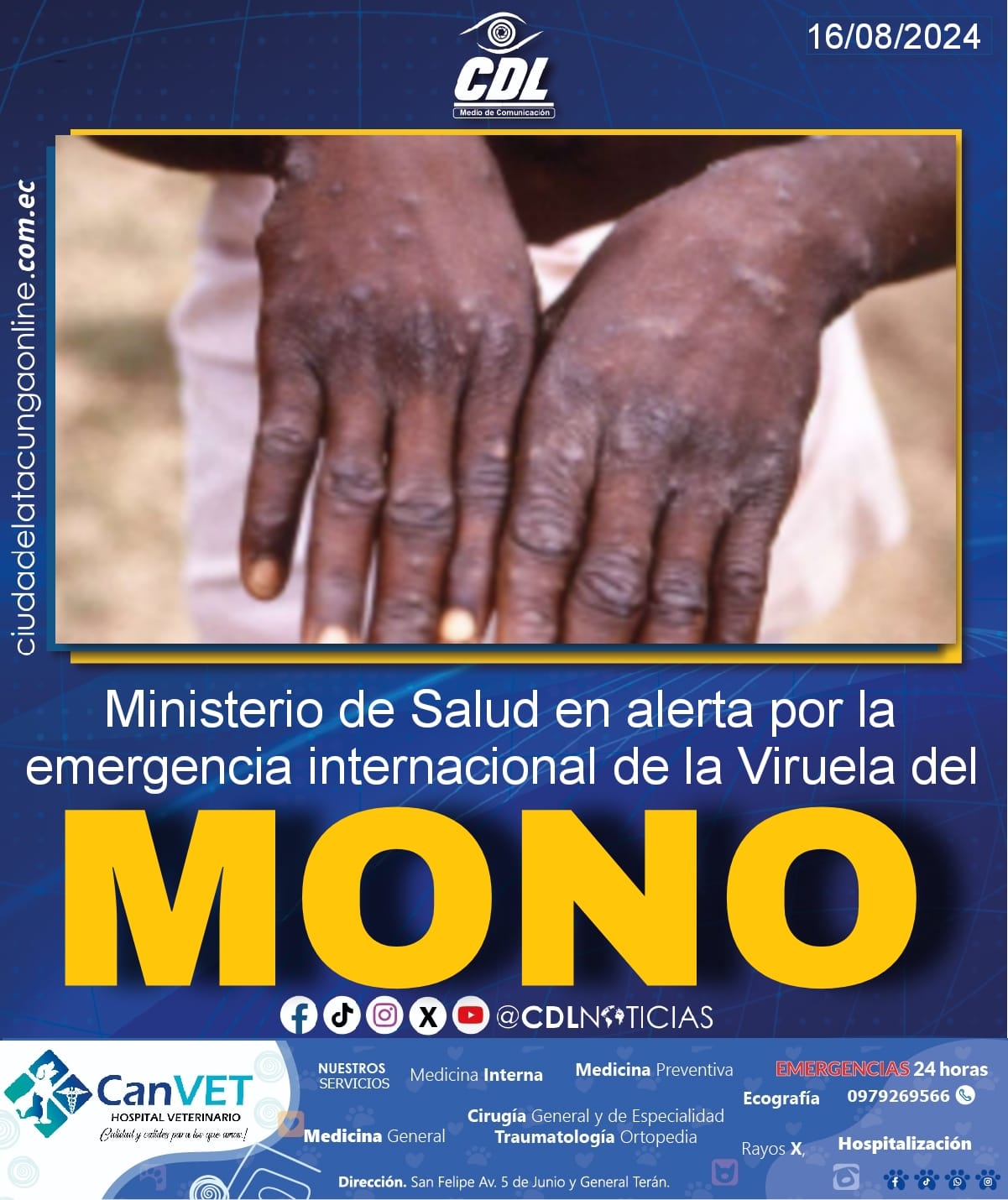 Viruela del Mono: Ministerio de Salud en alerta por la emergencia internacional