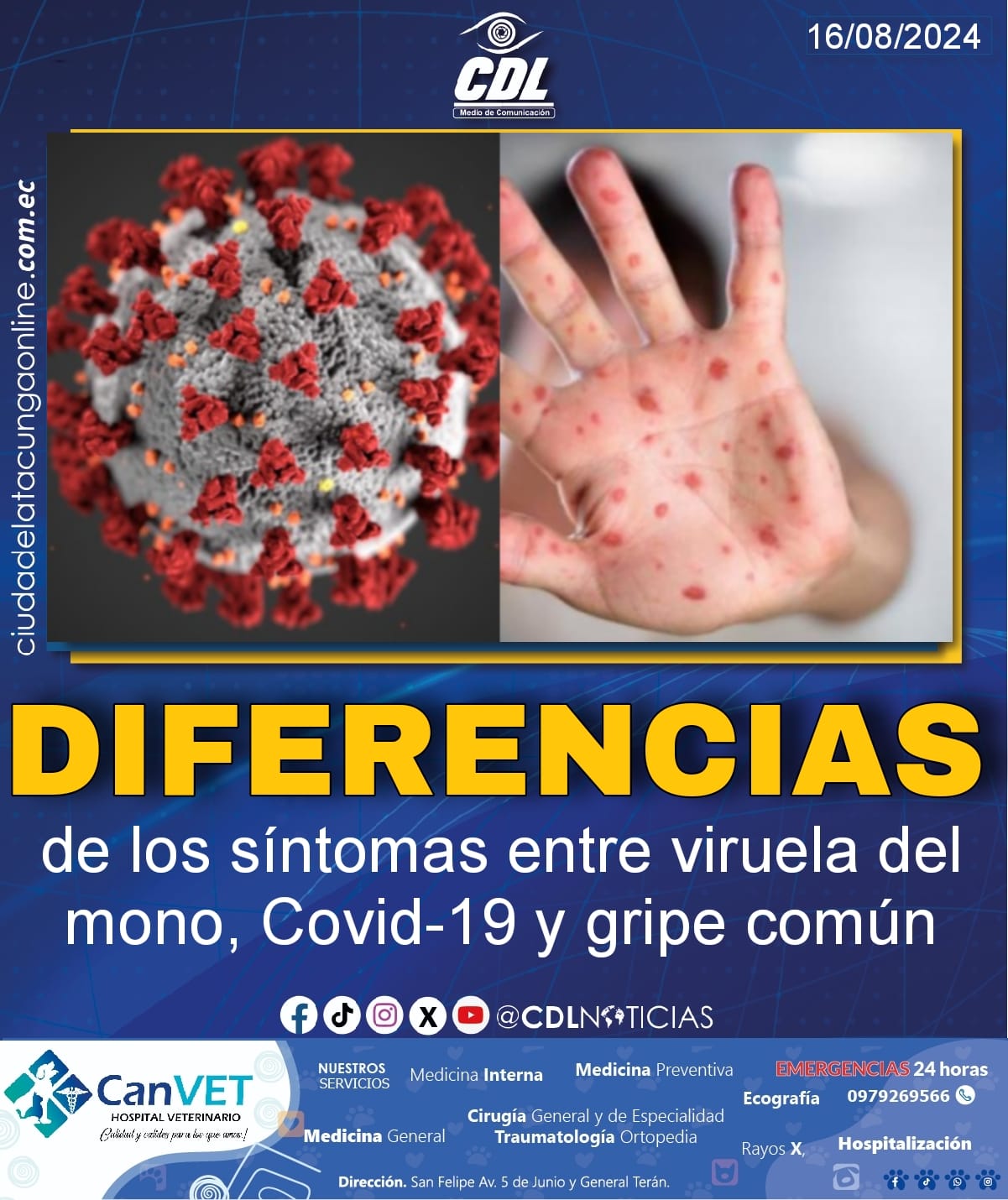 Diferencias de los síntomas entre viruela del mono, Covid-19 y gripe común