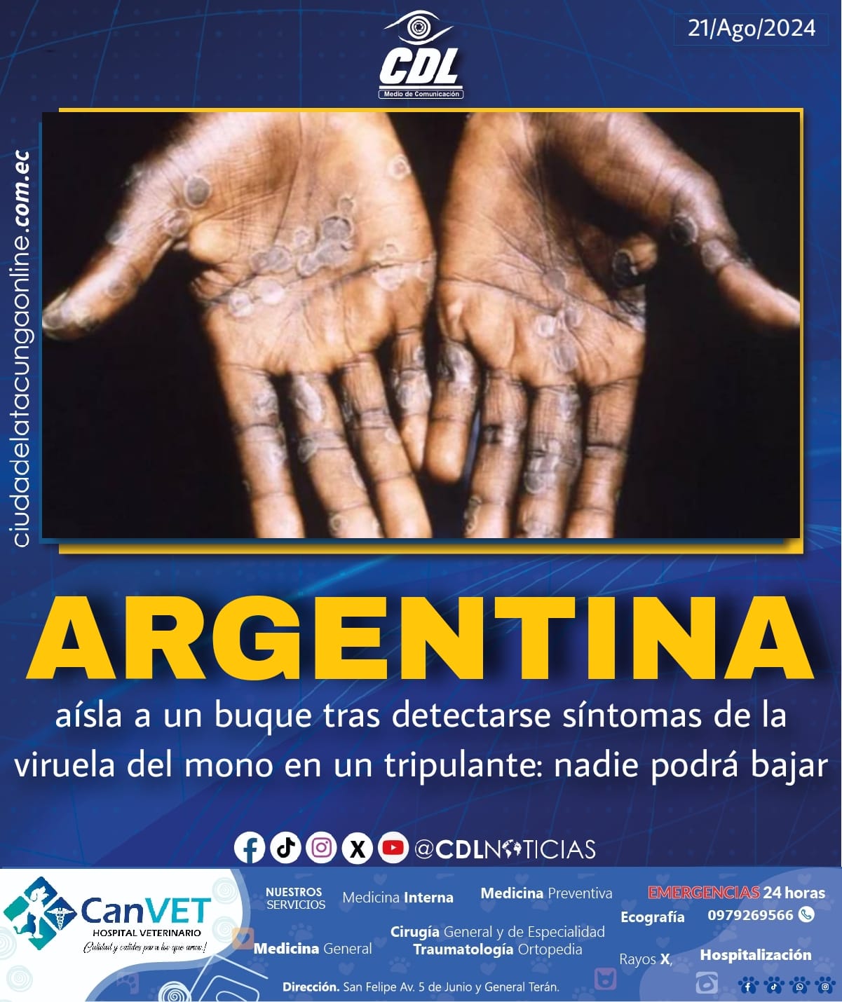 Argentina aísla a un buque tras detectarse síntomas de la viruela del mono en un tripulante: nadie podrá bajar