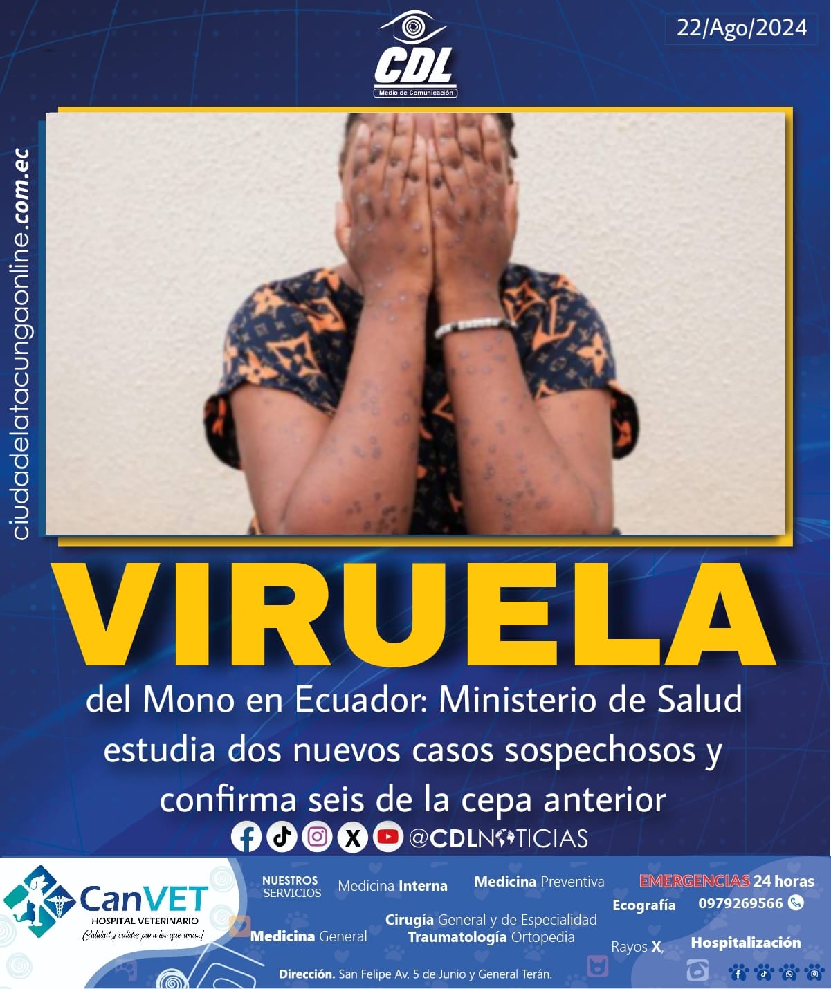 Viruela del Mono en Ecuador: Ministerio de Salud estudia dos nuevos casos sospechosos y confirma seis de la cepa anterior