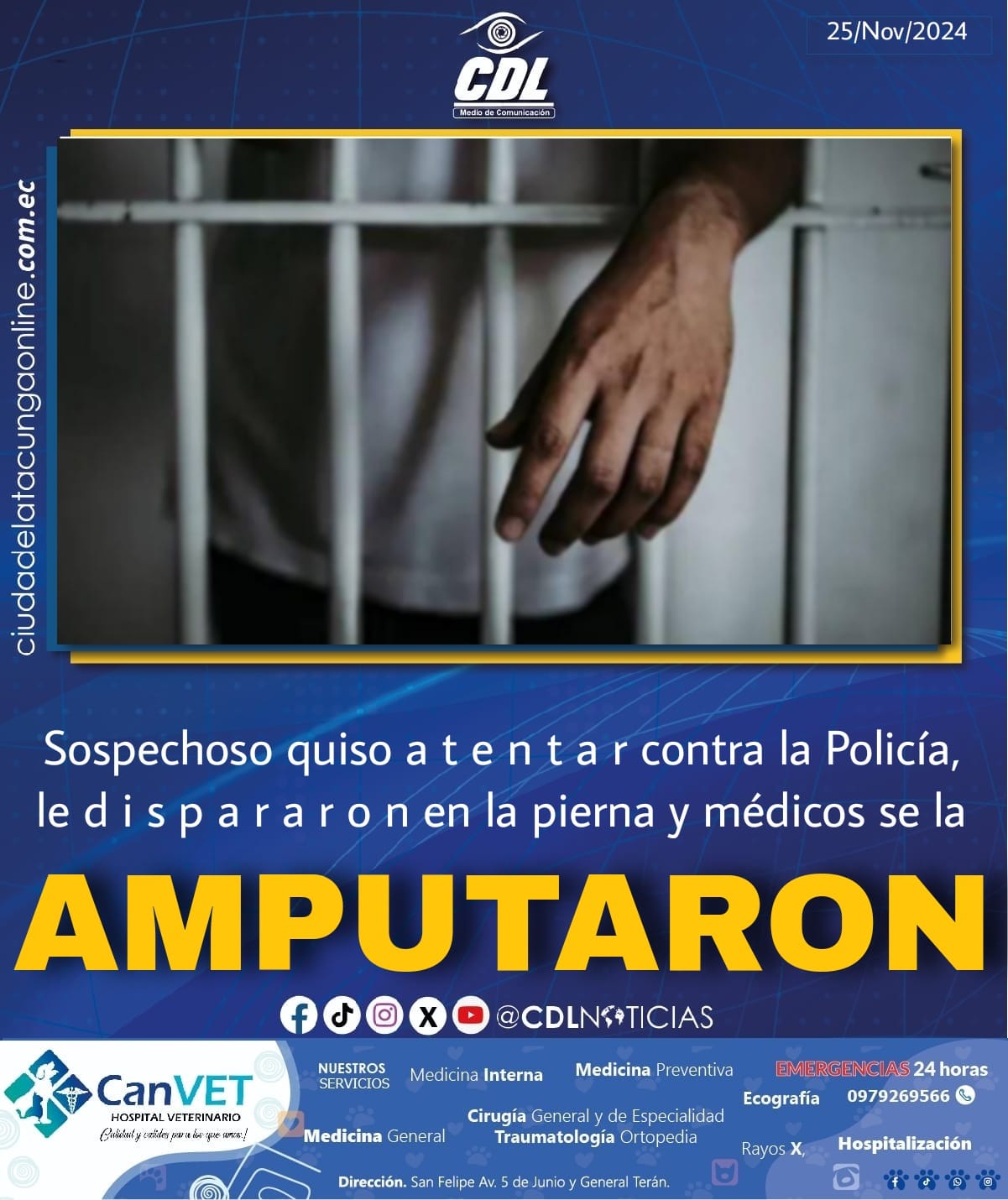 Un sospechoso quiso a t e n t a r contra la Policía, le d i s p a r a r o n en la pierna y médicos se la amputaron