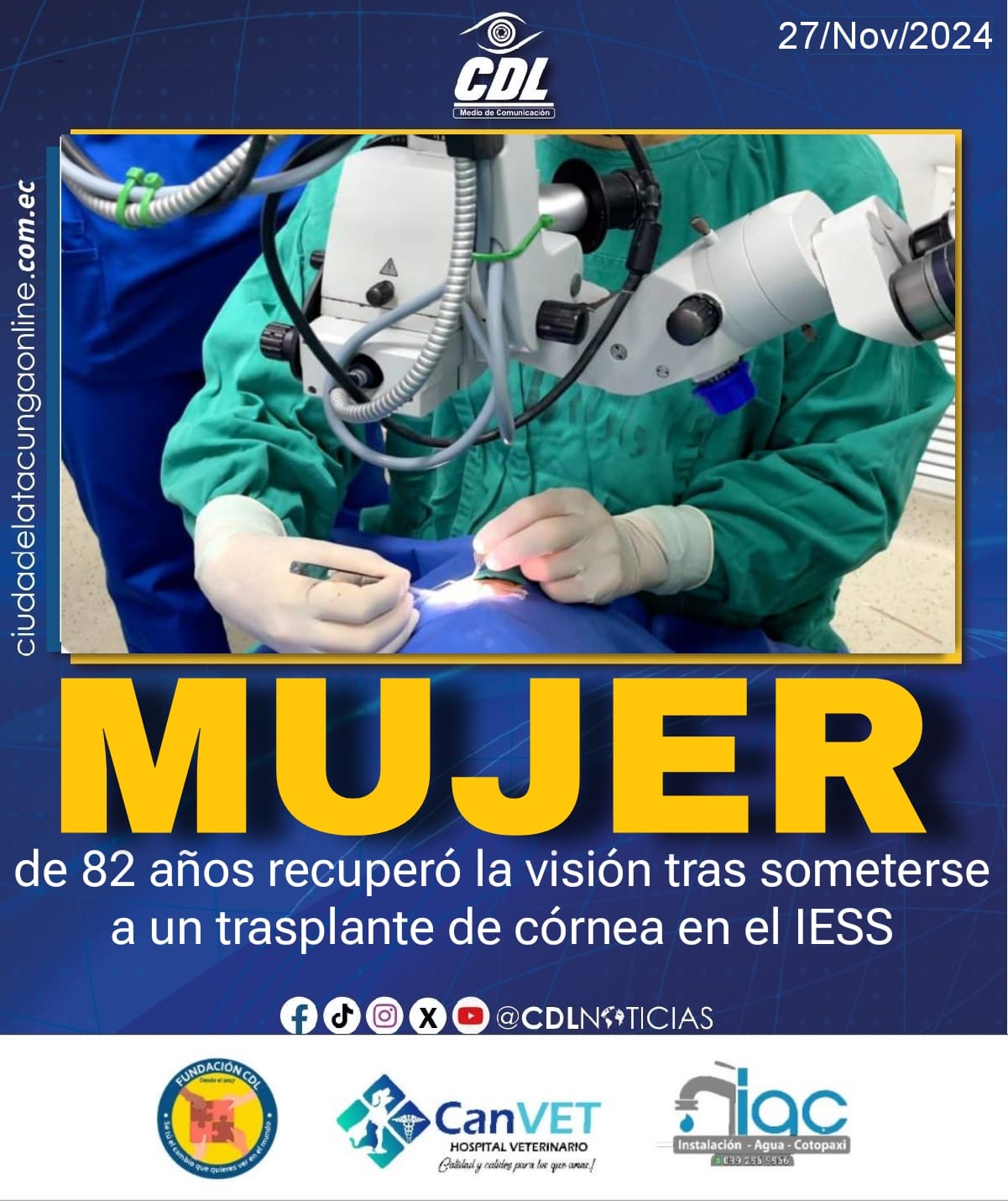 Mujer de 82 años recuperó la visión tras someterse a un trasplante de córnea en el IESS