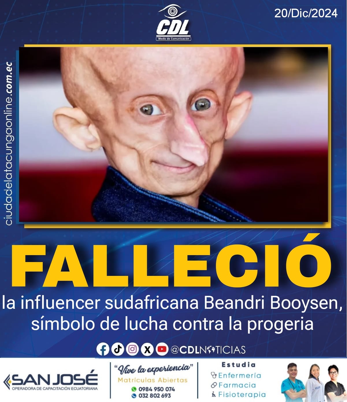Fallece la influencer sudafricana Beandri Booysen, símbolo de lucha contra la progeria