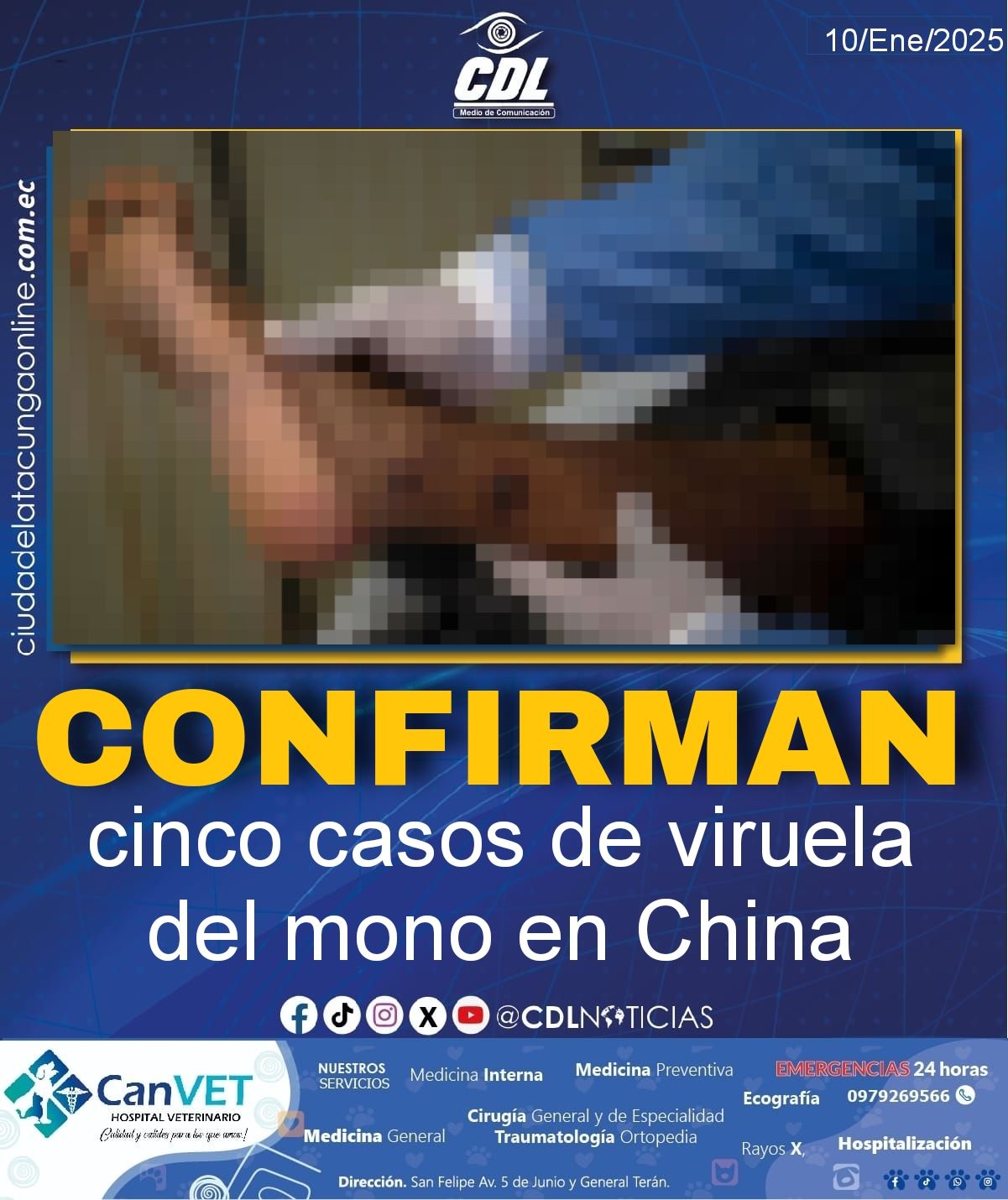 Confirman cinco casos de viruela del mono en China