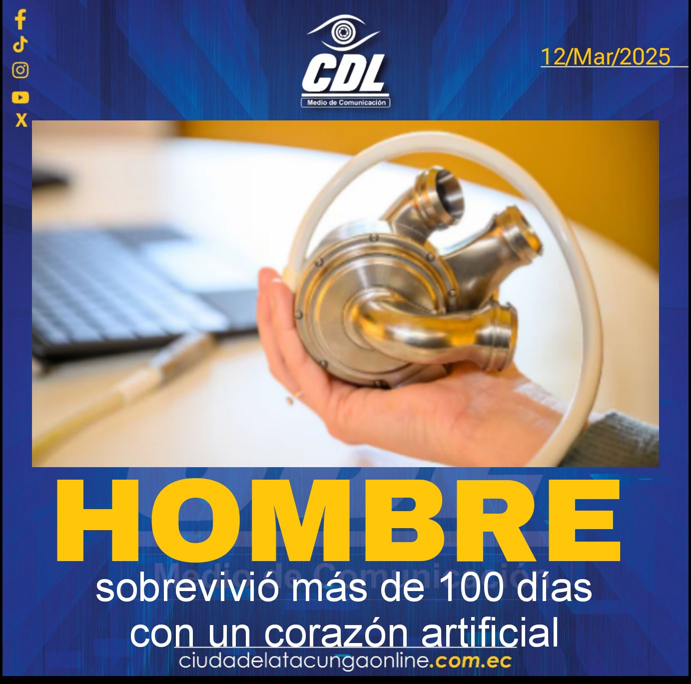 Hombre sobrevivió más de 100 días con un corazón artificial