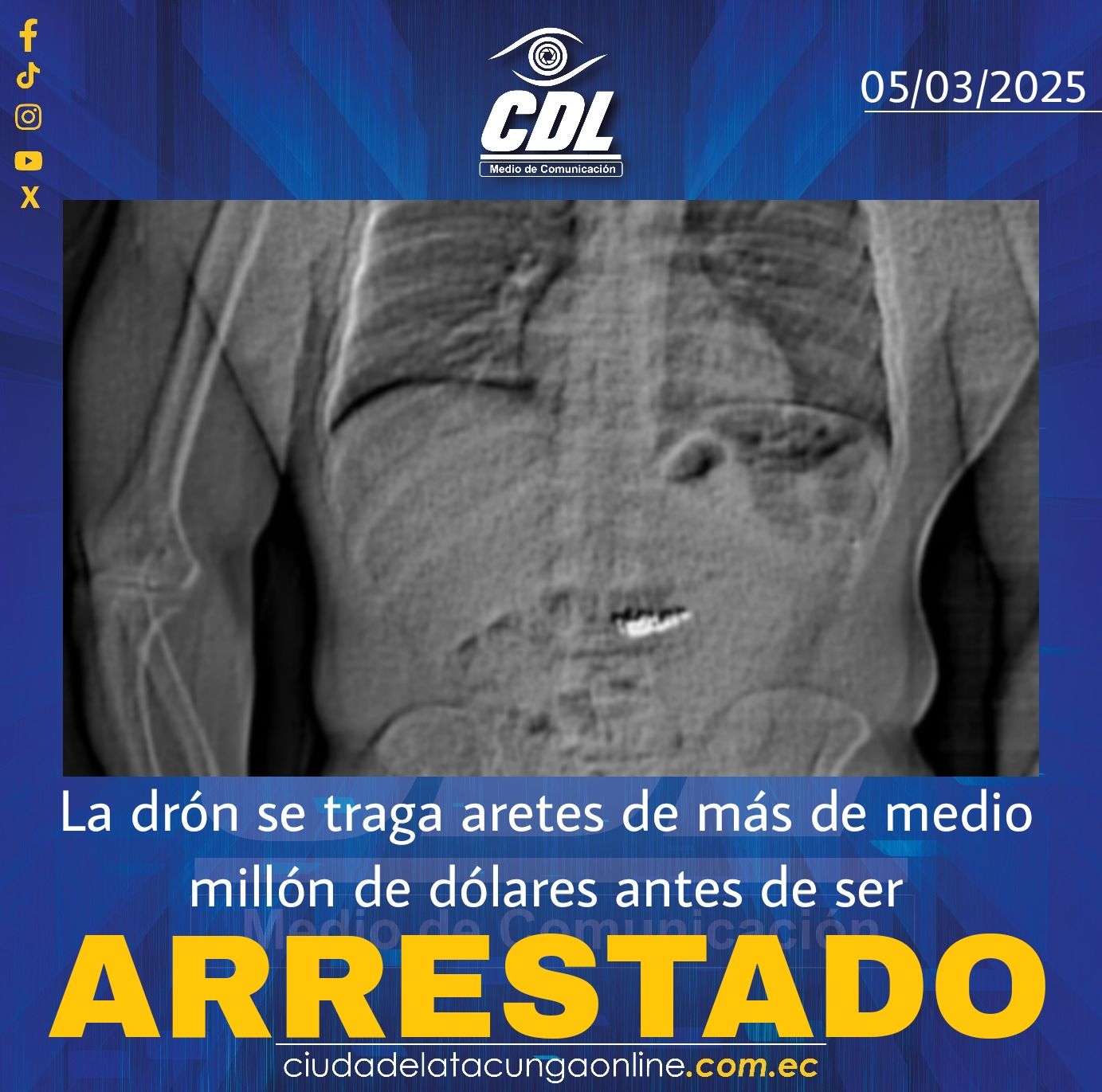 La drón se traga aretes de más de medio millón de dólares antes de ser arrestado