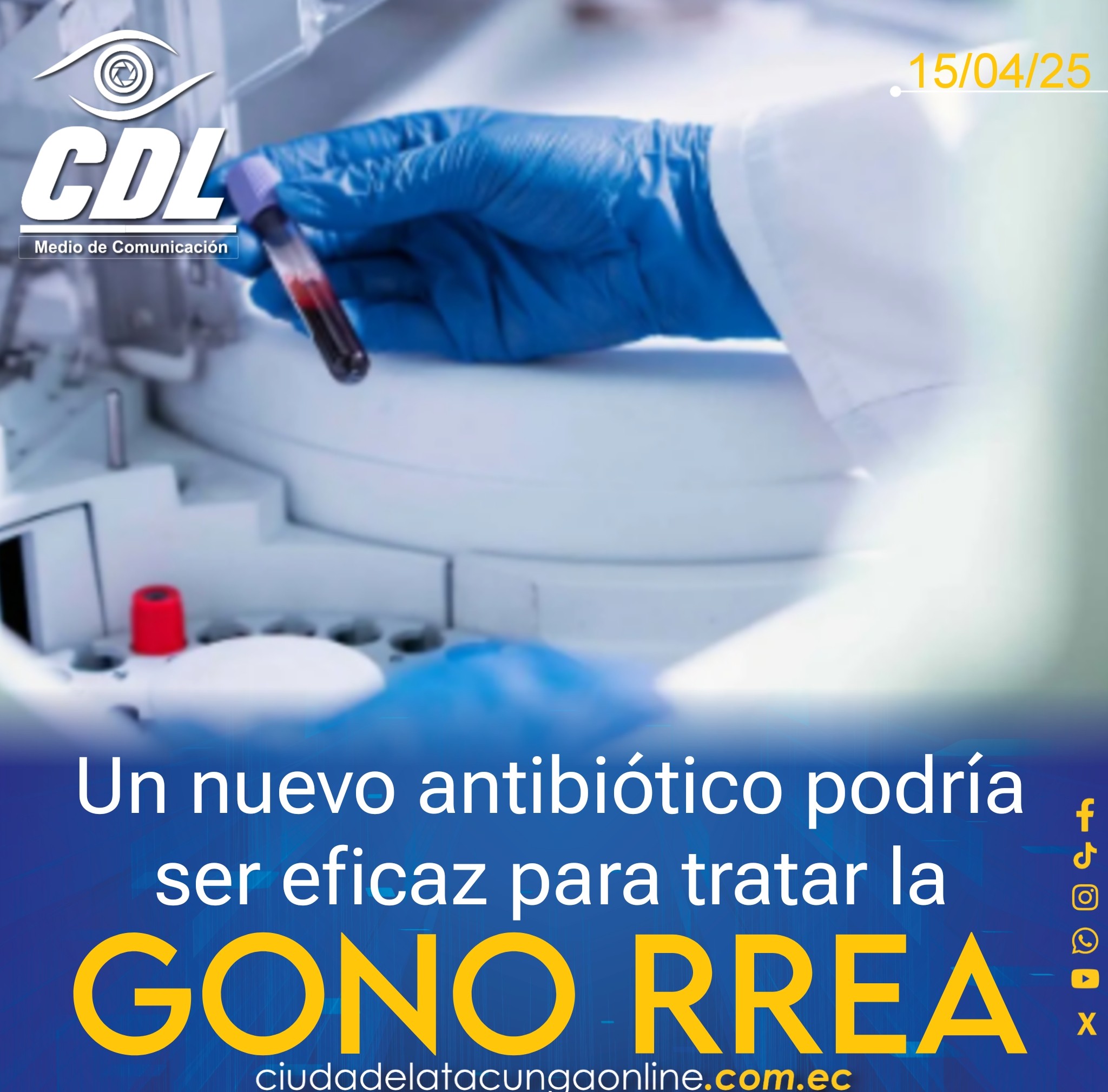 Un nuevo antibiótico podría ser eficaz para tratar la gonorrea