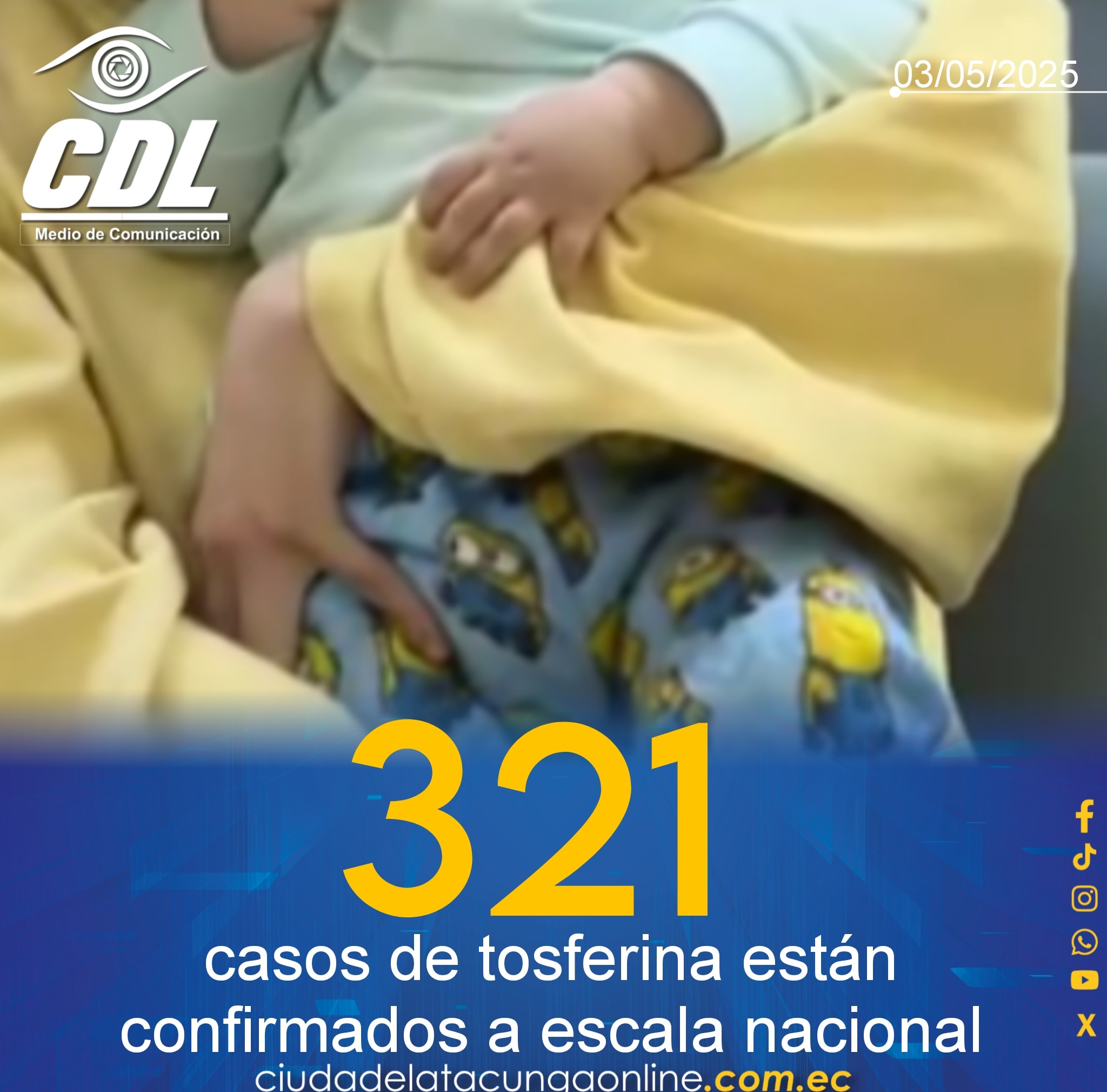 321 casos de tosferina están confirmados a escala nacional