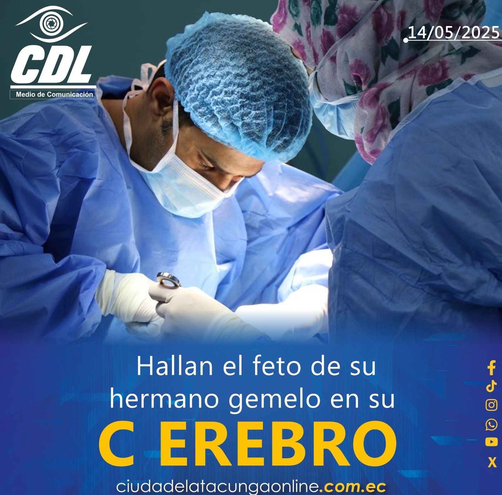 Hallan el feto de su hermano gemelo en su cerebro: un caso médico estremecedor