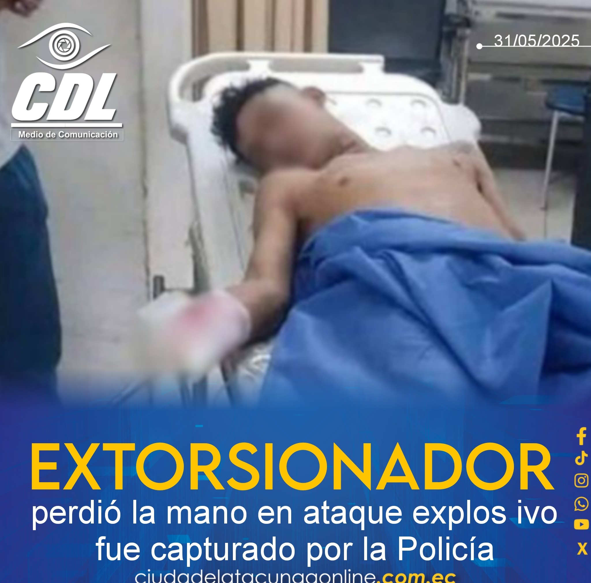 Extorsionador perdió la mano en ataque explos ivo fue capturado por la Policía