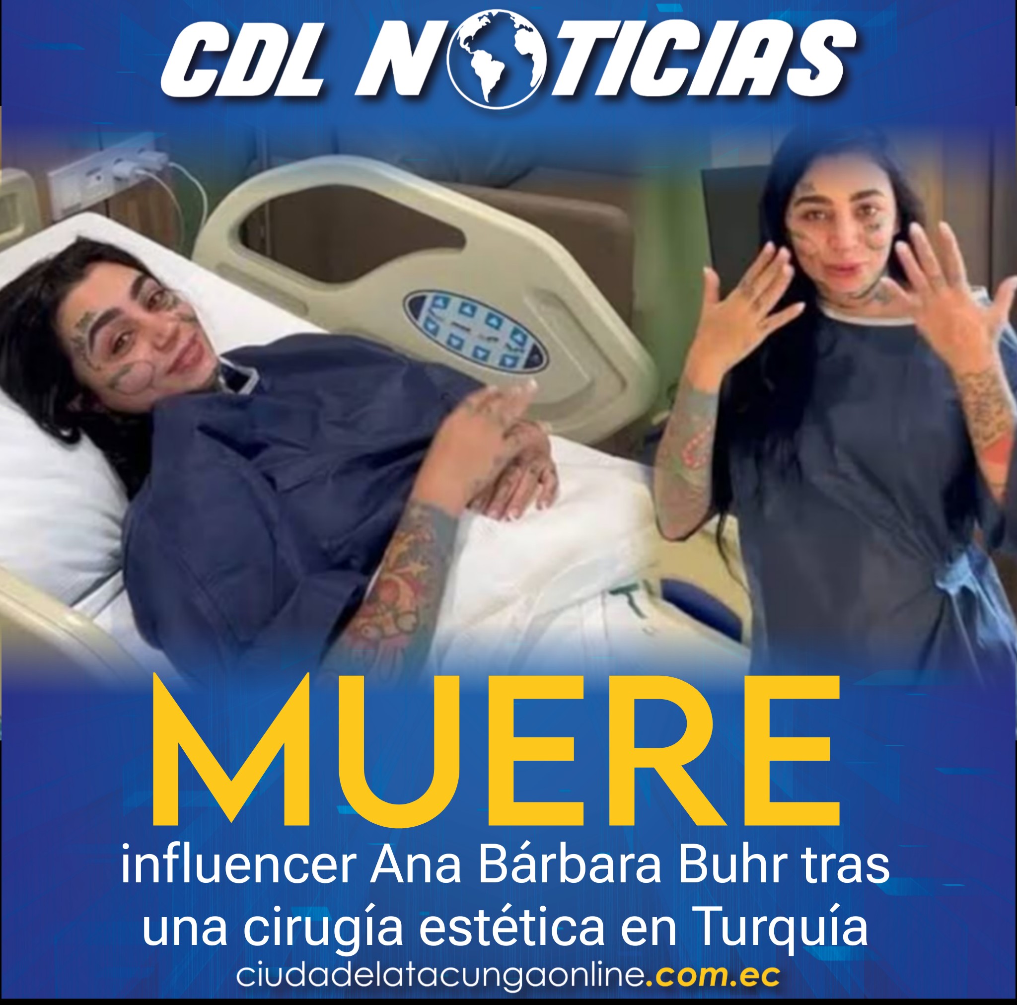 Muere influencer Ana Bárbara Buhr tras una cirugía estética en Turquía