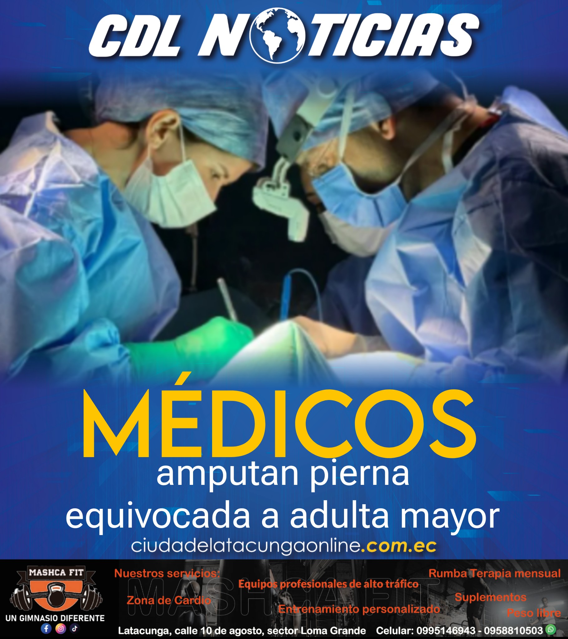 Médicos amputan pierna equivocada a adulta mayor