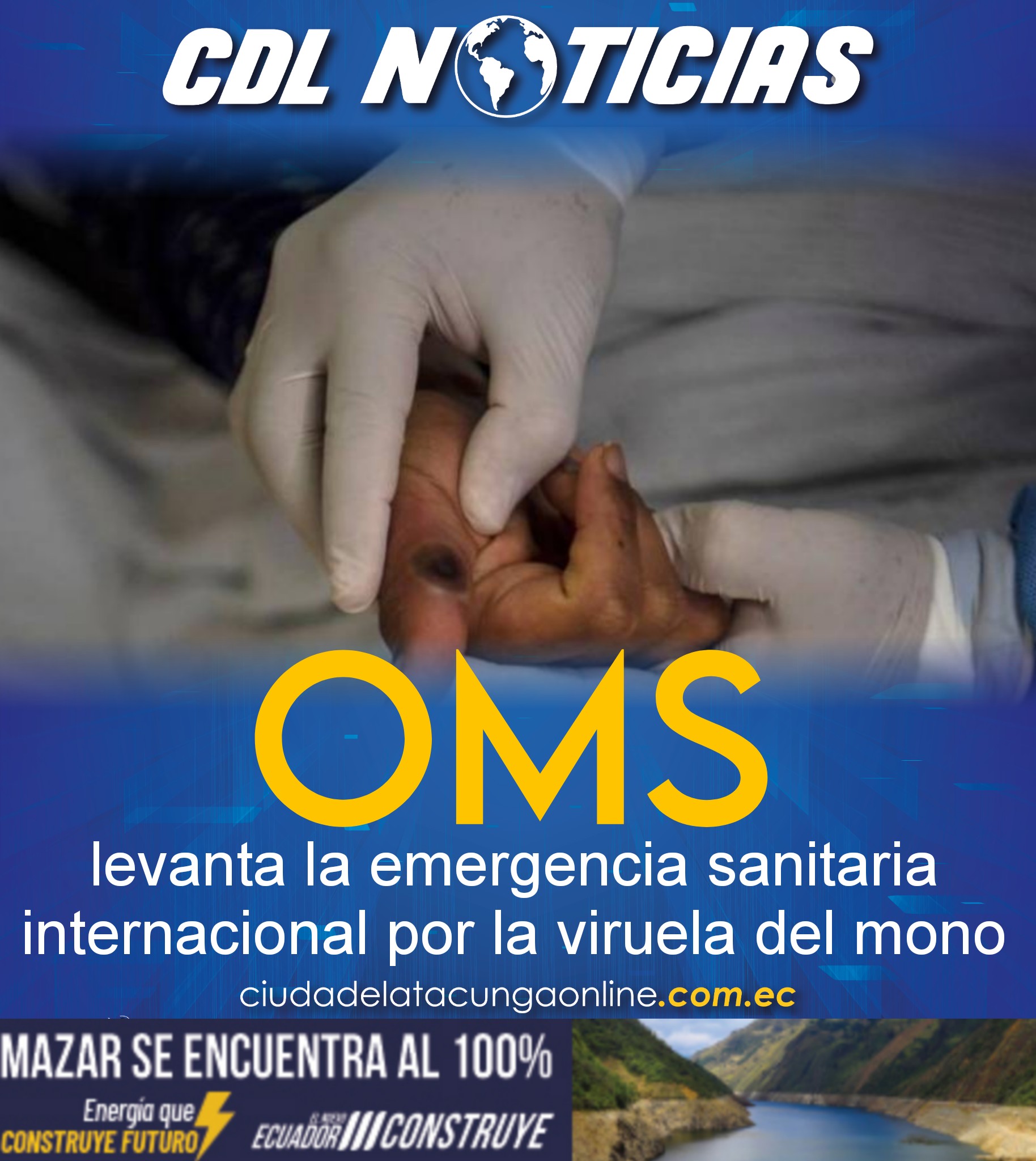 OMS levanta la emergencia sanitaria internacional por la viruela del mono