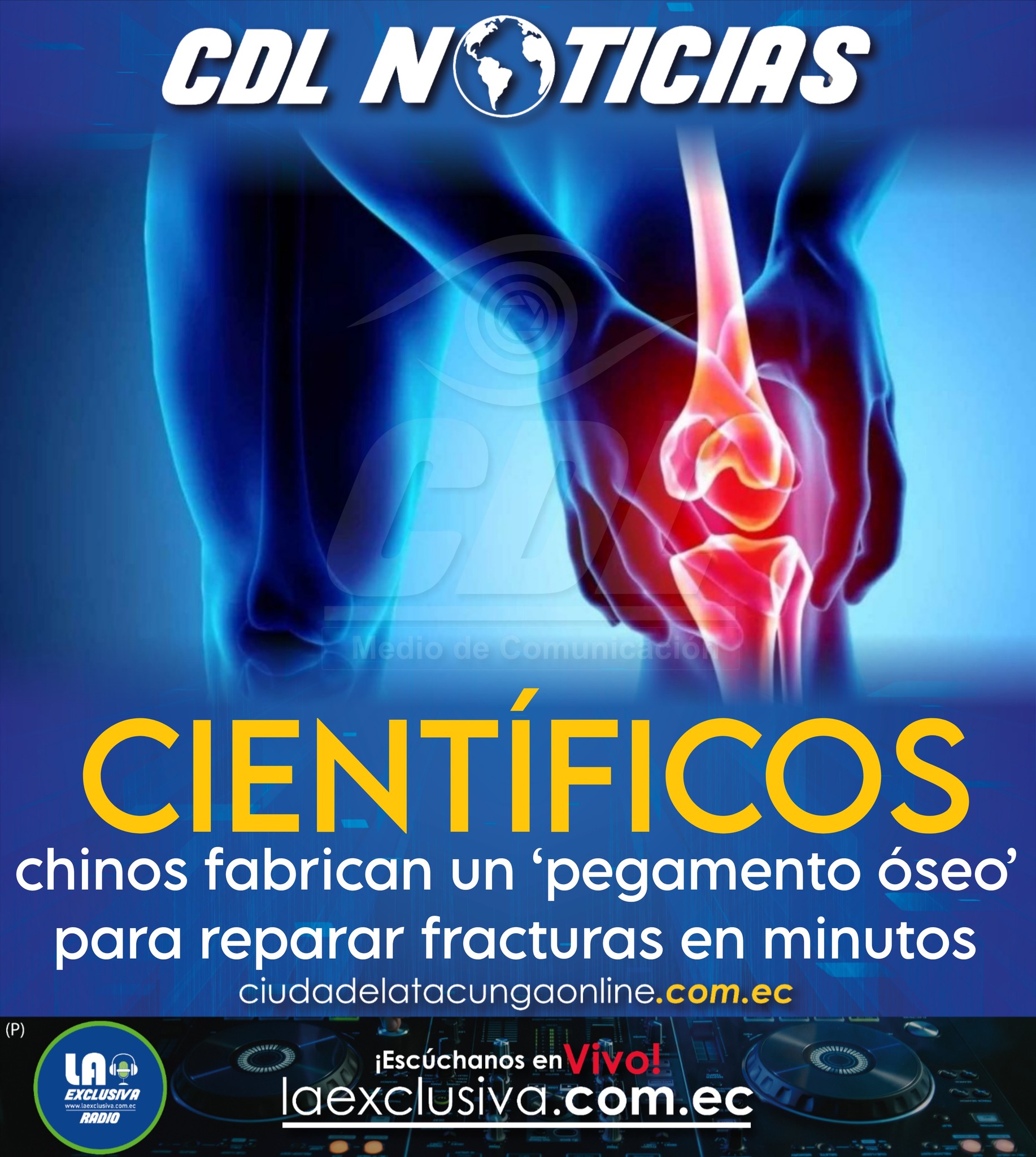 Científicos chinos fabrican un ‘pegamento óseo’ para reparar fracturas en minutos