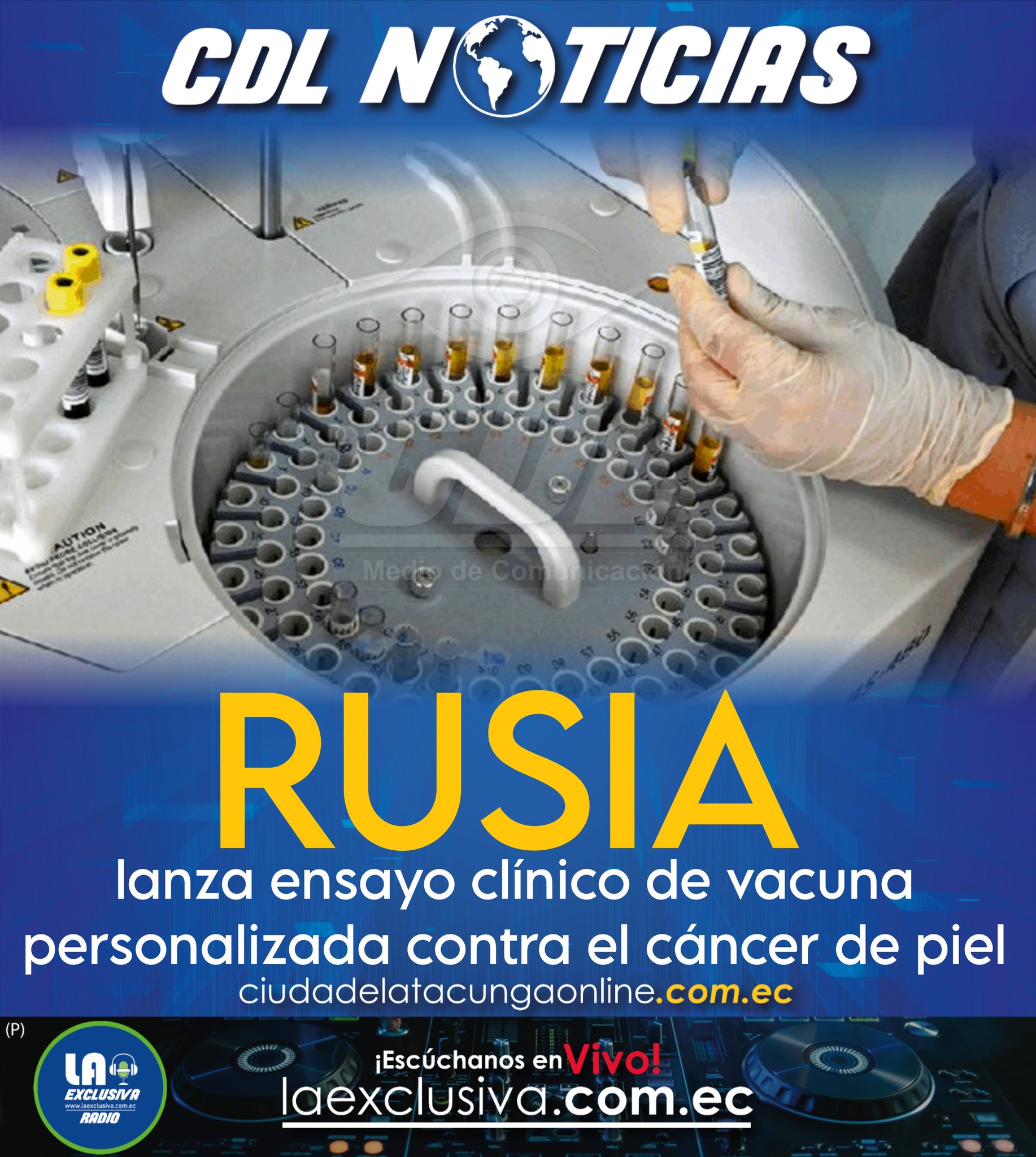 Rusia lanza ensayo clínico de vacuna personalizada contra el cáncer de piel