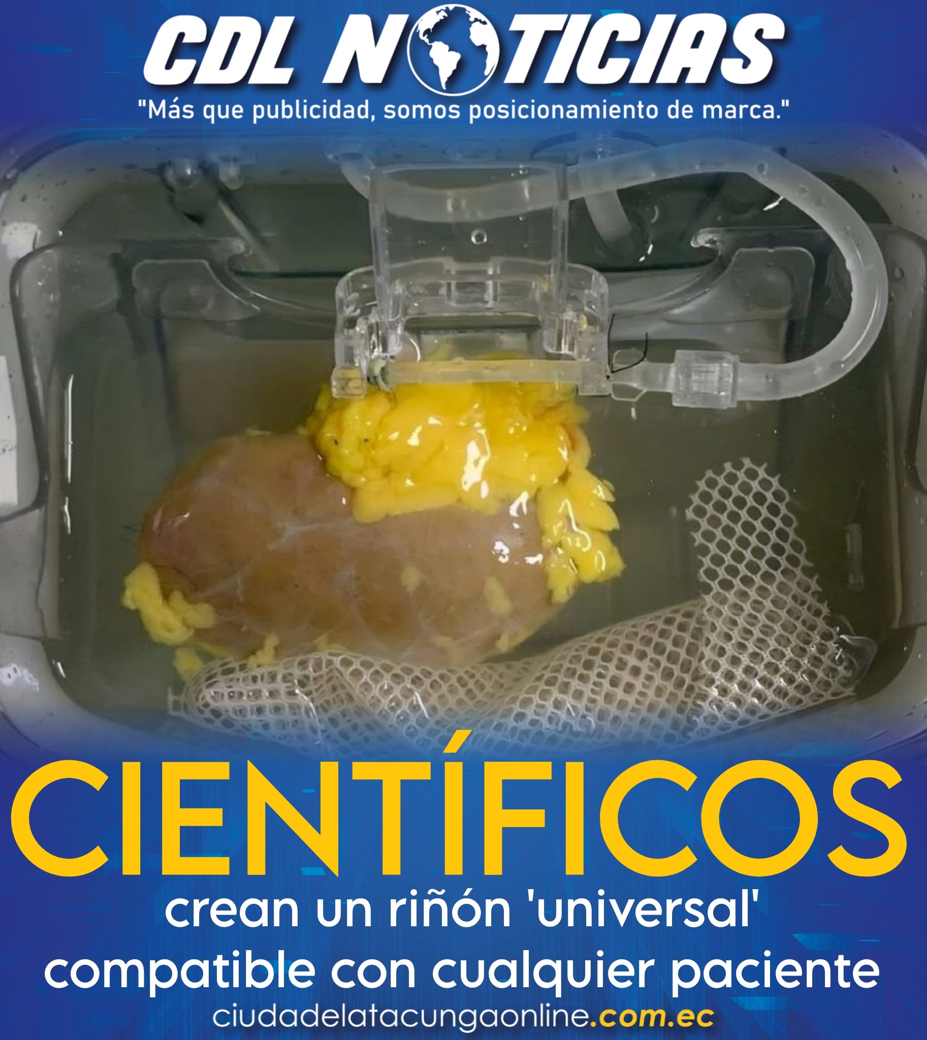 Científicos crean un riñón ‘universal’ compatible con cualquier paciente
