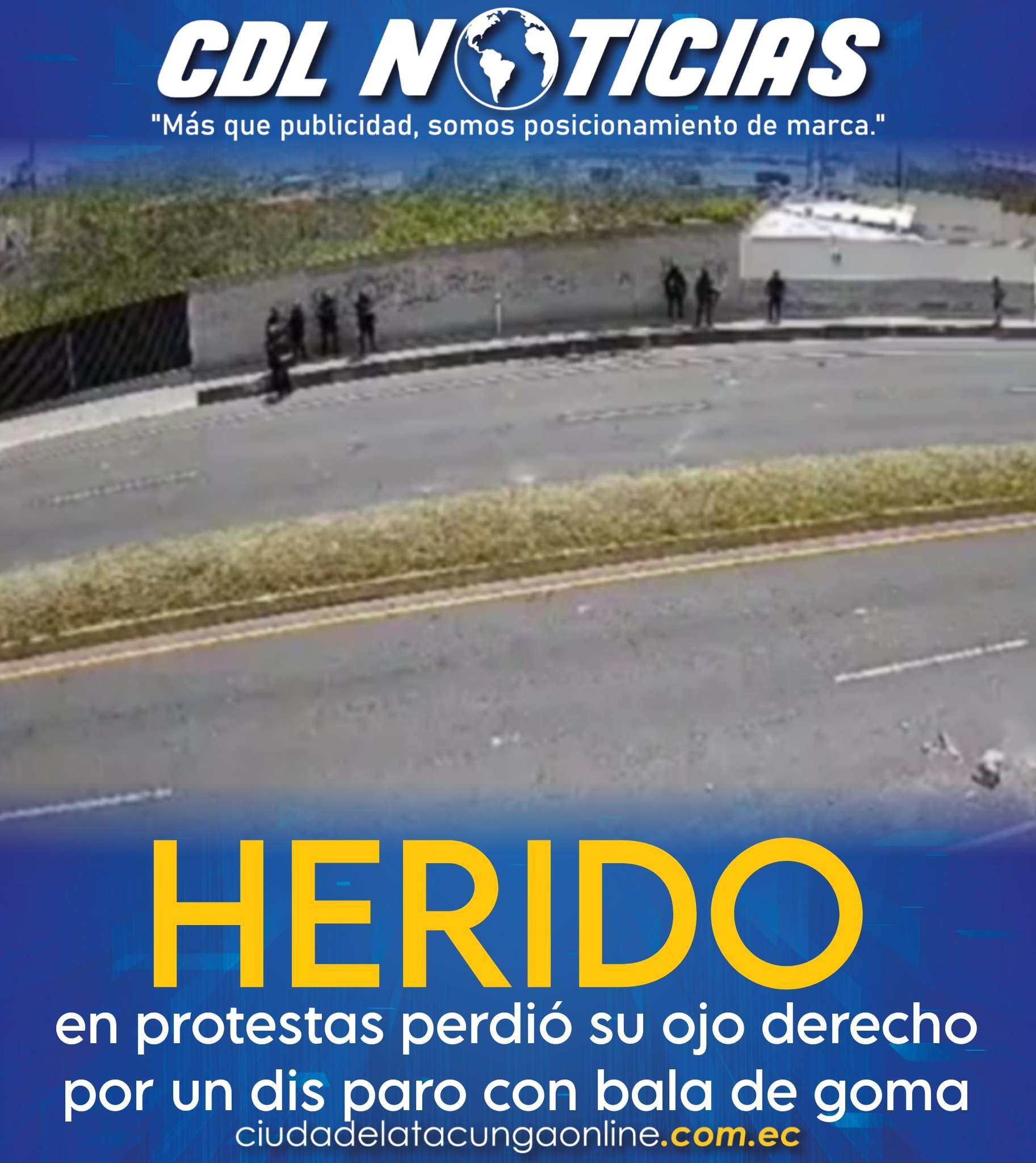 Herido en protestas perdió su ojo derecho por un dis paro con bala de goma