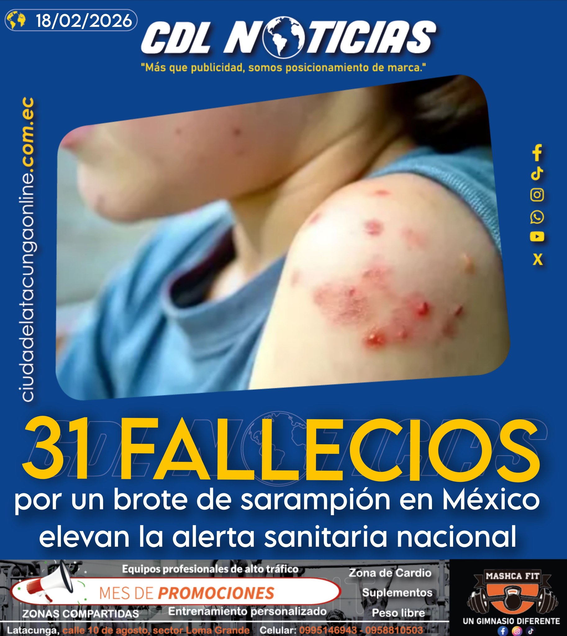 31 fallecidos por un brote de sarampión en México elevan la alerta sanitaria nacional