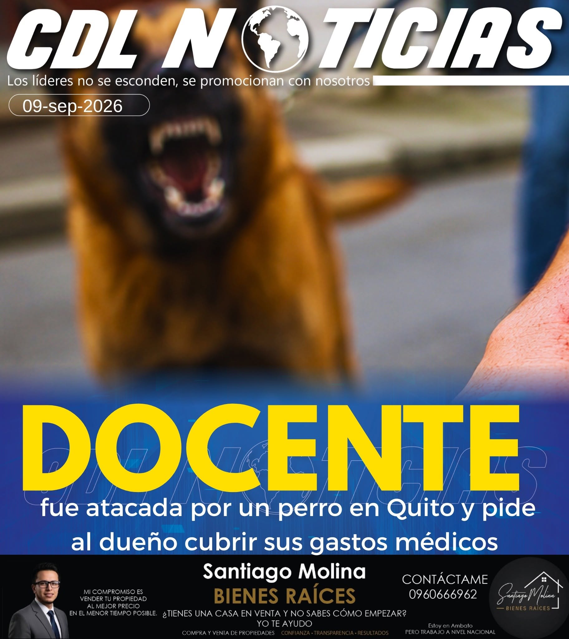 Docente fue atacada por un perro en Quito y pide al dueño cubrir sus gastos médicos